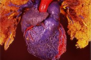 Model of the human heart, posterior view.
