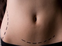 Plastic Surgery iPhone App: Medical Aid or Just Plain Creepy?