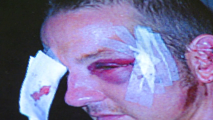 Fry’s Settles with Beaten Shoplifter