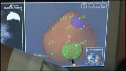 Targeted Biopsy Marks Major Advance in Prostate Cancer Research