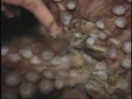 Star's Son Has Close Encounter With Octopus
