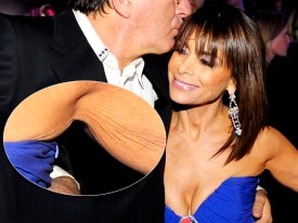 Eww! Celebrities