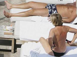Sunburn Isn't the Only Danger at Nude Beaches
