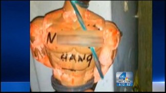 Police, Hospital Investigating Racist Display