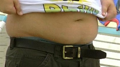New incision-free procedure reduces weight after failed gastric bypass surgery. New incision-free procedure reduces weight after failed gastric bypass surgery.