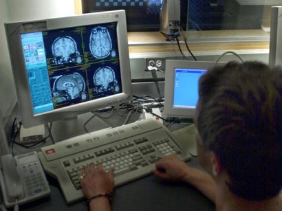 brain MRI study