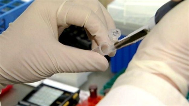 Treating Heart Attacks With Stem Cells