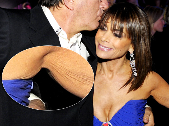 Eww! Celebrities