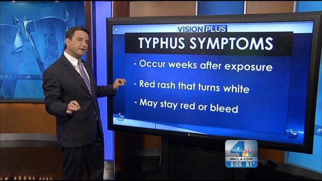 Health officials in Orange County are working hard to stop a single incident of typhus from becoming an outbreak. But what is typhus and how do you spot it? Dr. Bruce Hensel explains the symptoms and treatment during the NBC4 News at 5 p.m. on May 29, 2012.