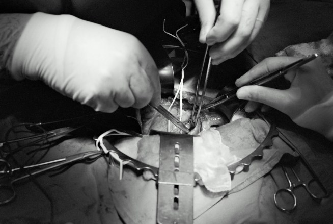 Oh Negative: Man Selling Kidney on Craigslist