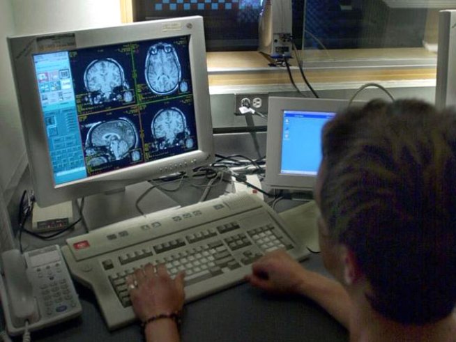 UCLA Study: Test Might End Medication Guessing Game