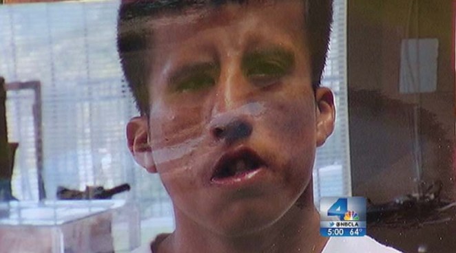 Augustine Pascal issued a tearful plea Monday asking the driver who fatally struck his disabled brother, Miguel Mendez, to come forward. Detectives say they are working with one key piece of evidence, surveillance video of the van involved in the crash. Angie Crouch reports from South LA for the NBC4 News at 5 p.m. on Nov. 19, 2012.