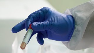 A health worker holds a testing tube after conducing at a drive-through COVID-19 test at KPJ Damansara Specialist Hospital, in Petaling Jaya, Malaysia