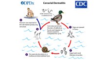 Cercarial_LifeCycle_lg-cdc
