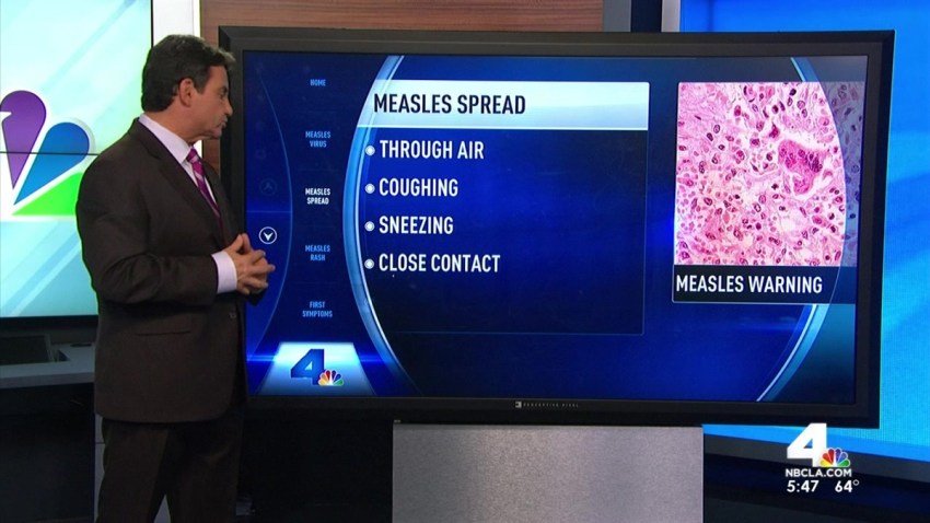 Hensel_Measles_Web_1200x675_381907523518.jpg