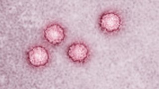 HepatitisA
