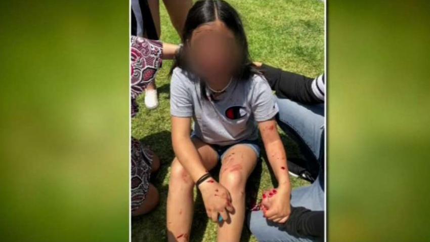 Mom Says 12 Year Old Girl Was Bullied And Beaten Nbc Los Angeles