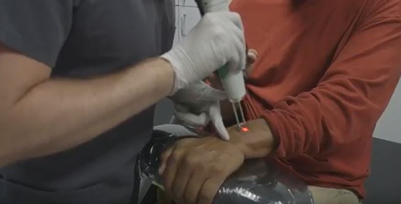 DA's Tattoo Removal program