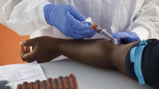 A phlebotomist wearing protective gloves draws blood from a patient for a Covid-19 antibody test at a GUARDaHEART Foundation testing site in Los Angeles, California, U.S., on Wednesday, Aug. 5, 2020. California reported 202 new virus deaths, marking its second-deadliest day of the pandemic. The state has had 9,703 Covid fatalities. Photographer: Patrick T. Fallon/Bloomberg via Getty Images