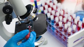 Scientist using microscope conducting genetic research of blood sample in laboratory.