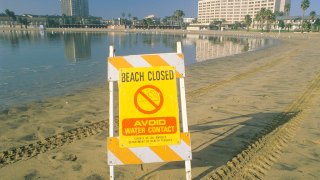 File Image: A sign reading “Avoid Water Contact” warning people that a beach at Marina del Rey, Los Angeles, California, is closed due to pollution (Photo by: Joe Sohm/Visions of America/Universal Images Group via Getty Images)