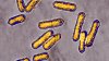 At least 10 people sickened in US listeria outbreak linked to prepared foods