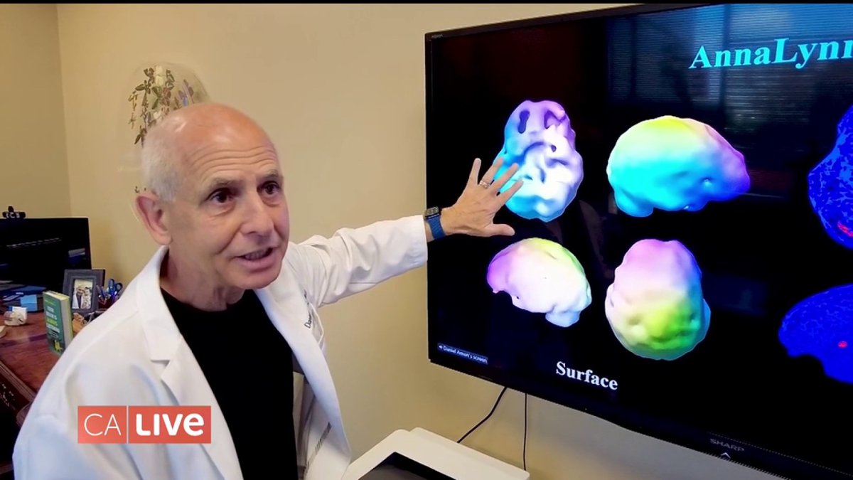 Meet the Psychiatrist Who Cures the Brain – NBC Los Angeles