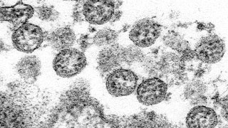 electron microscope image shows the spherical coronavirus particles from what was believed to be the first U.S. case of COVID-19
