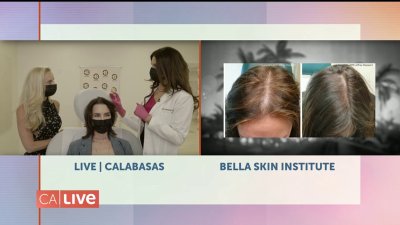 3 Tips for Hair Restoration from Celebrity Dermatologist – NBC Los Angeles