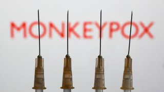 The World Health Organization has said that there is a “window” of opportunity to contain a recent monkeypox outbreak which has seen cases spread across Europe, the U.S. and Australia.