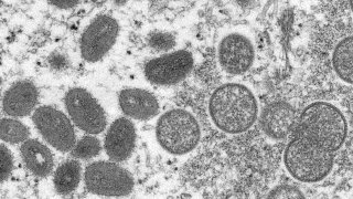 (Cynthia S. Goldsmith, Russell Regner/CDC via AP, file)