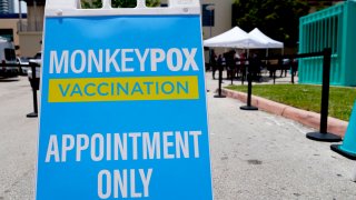 Monkeypox Florida