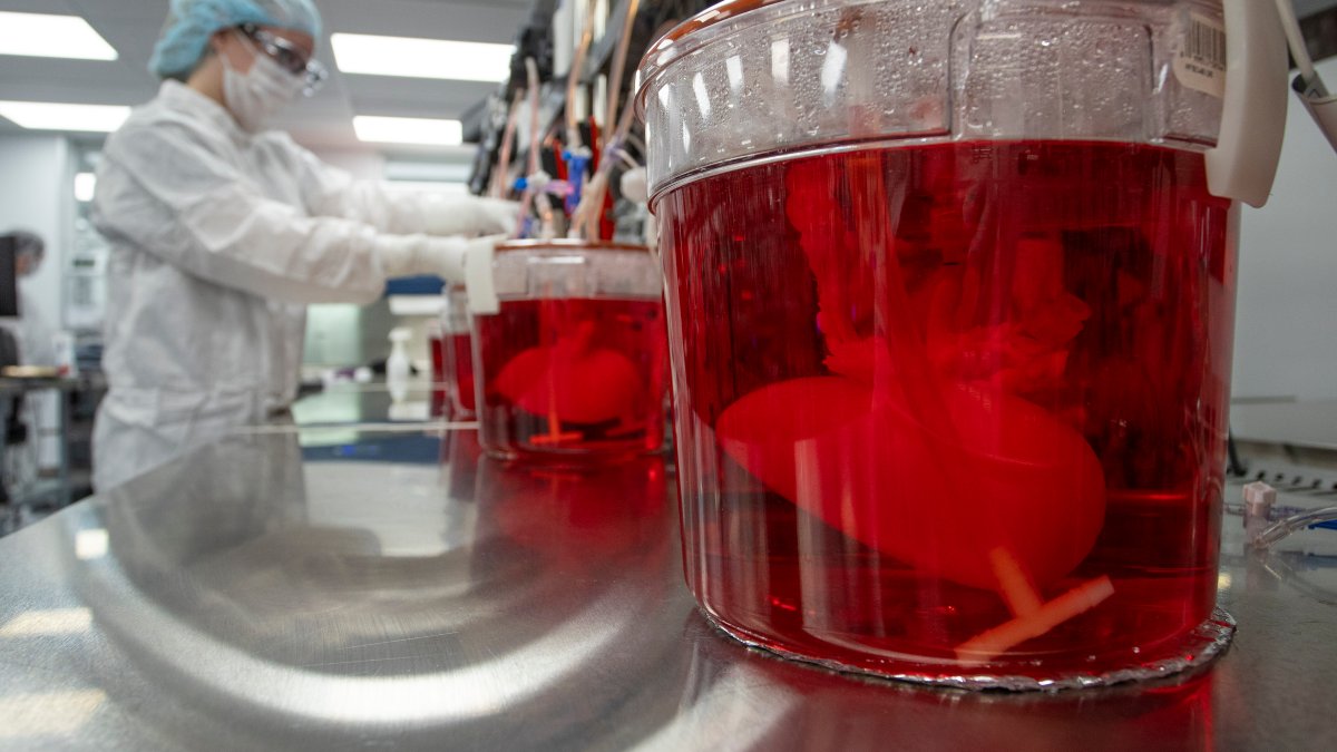 Scientists Seek to Use Pig Livers to Ease Organ Shortage – NBC Los Angeles - Vimarsana News