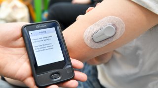Dexcom’s latest continuous glucose monitoring (CGM) system, to launch in February, will be 60% smaller and warm up 75% faster than previous versions such as this one, pictured on April 8, 2019.