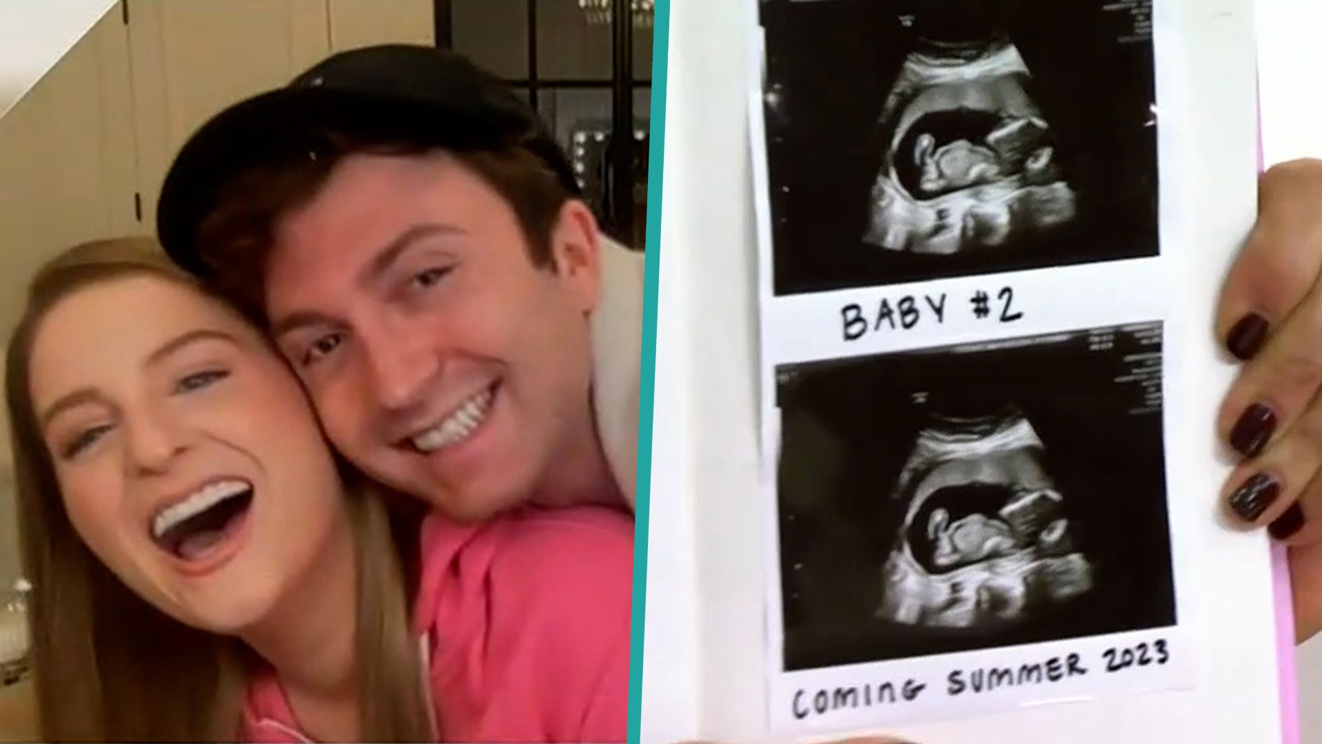 Meghan Trainor & Daryl Sabara Expecting Baby No. 2 – NBC Los Angeles
