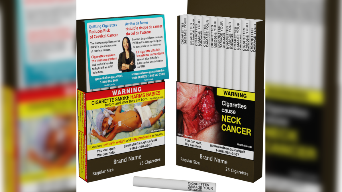 Canada Unveils World's First Individual Cigarette Warning Labels – NBC Los Angeles - Vimarsana News