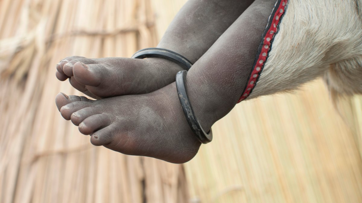 300 children rescued after 71 died in a Sudanese orphanage – NBC Los Angeles - Vimarsana News