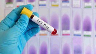 Blood sample for respiratory syncytial virus (RSV) test