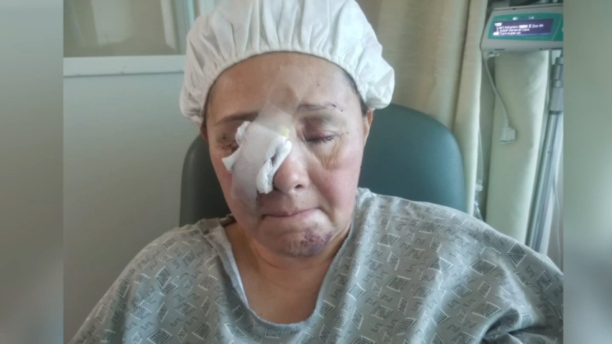 Norwalk mother left unconscious following home invasion attack - Vimarsana News