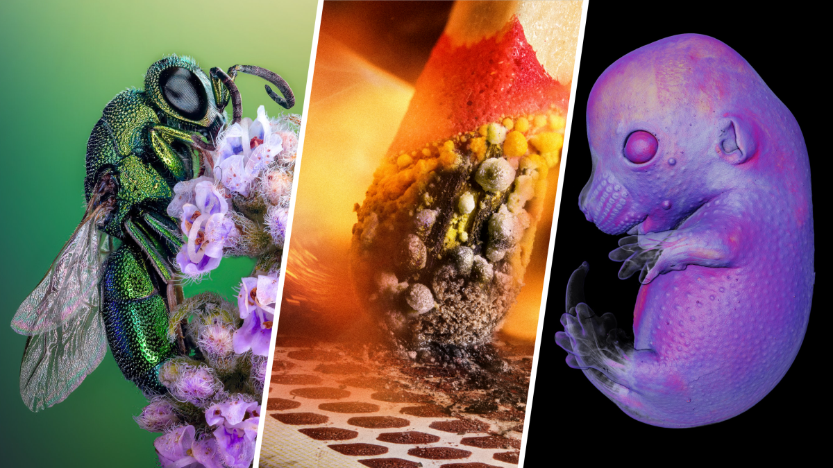 Microscopic Masterpieces: See the images that bridge art and science - Vimarsana News