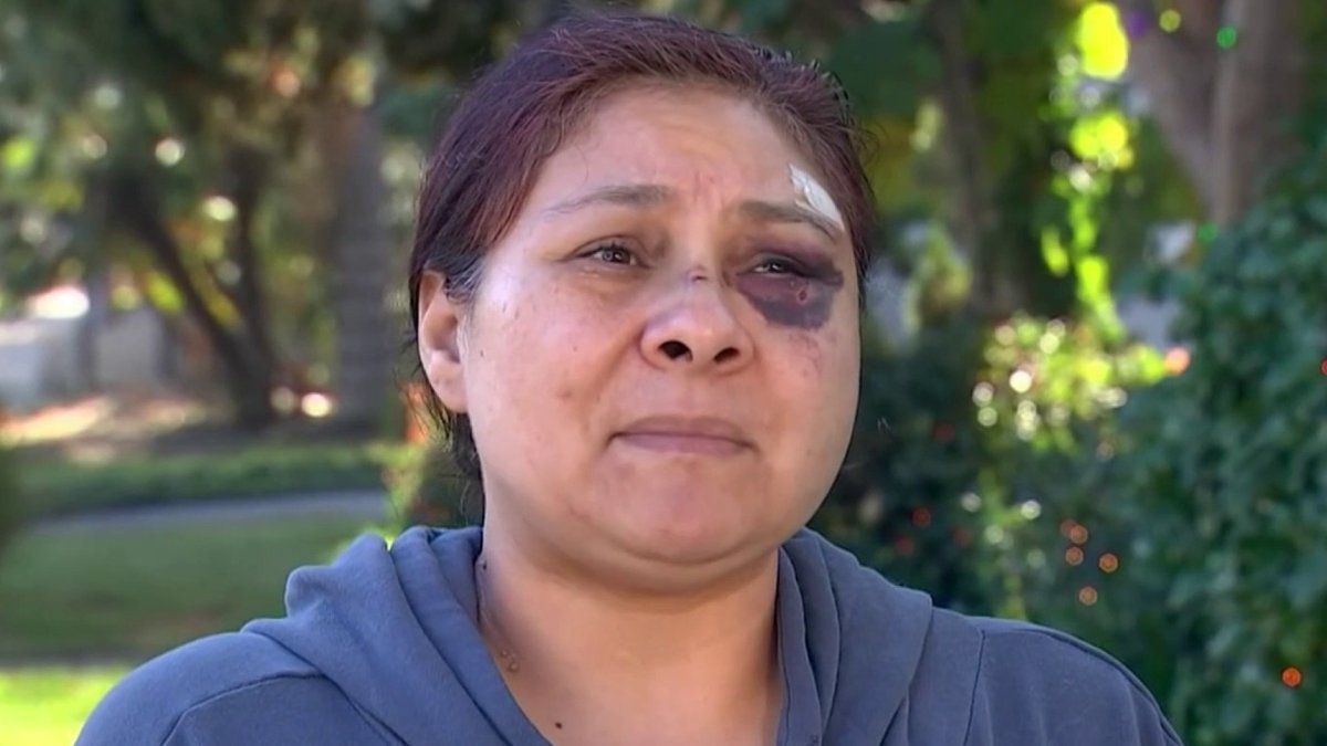 Woman Fights Off Attacker In Long Beach Nbc Los Angeles