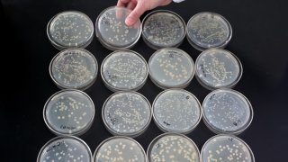 A probiotic culture experiment in a laboratory.