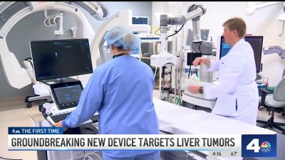 Groundbreaking new device targets liver tumors