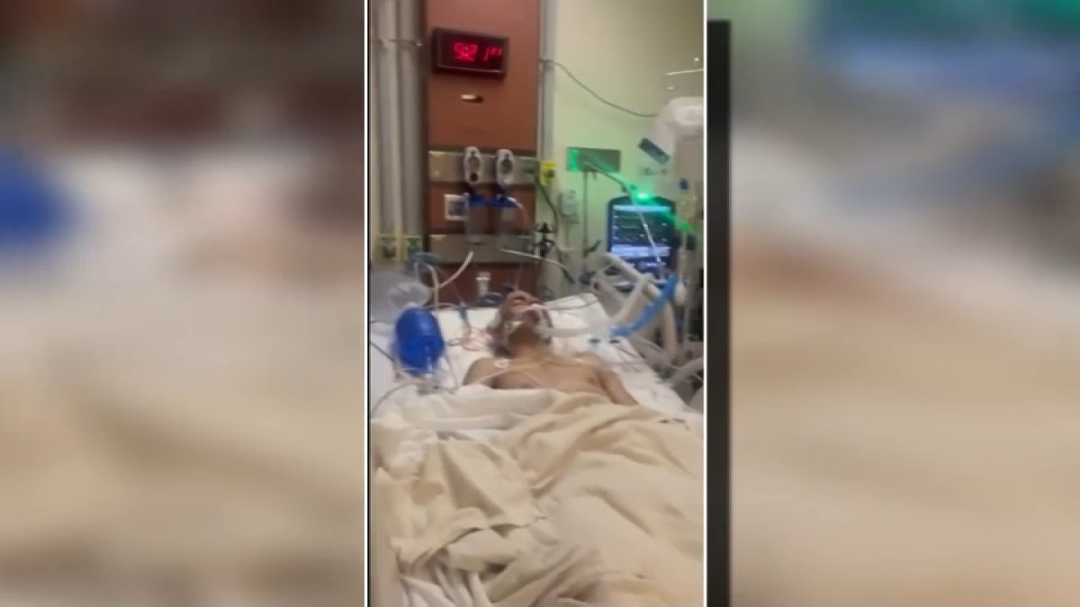 Teen who was attacked in Watts undergoes second surgery – NBC Los Angeles