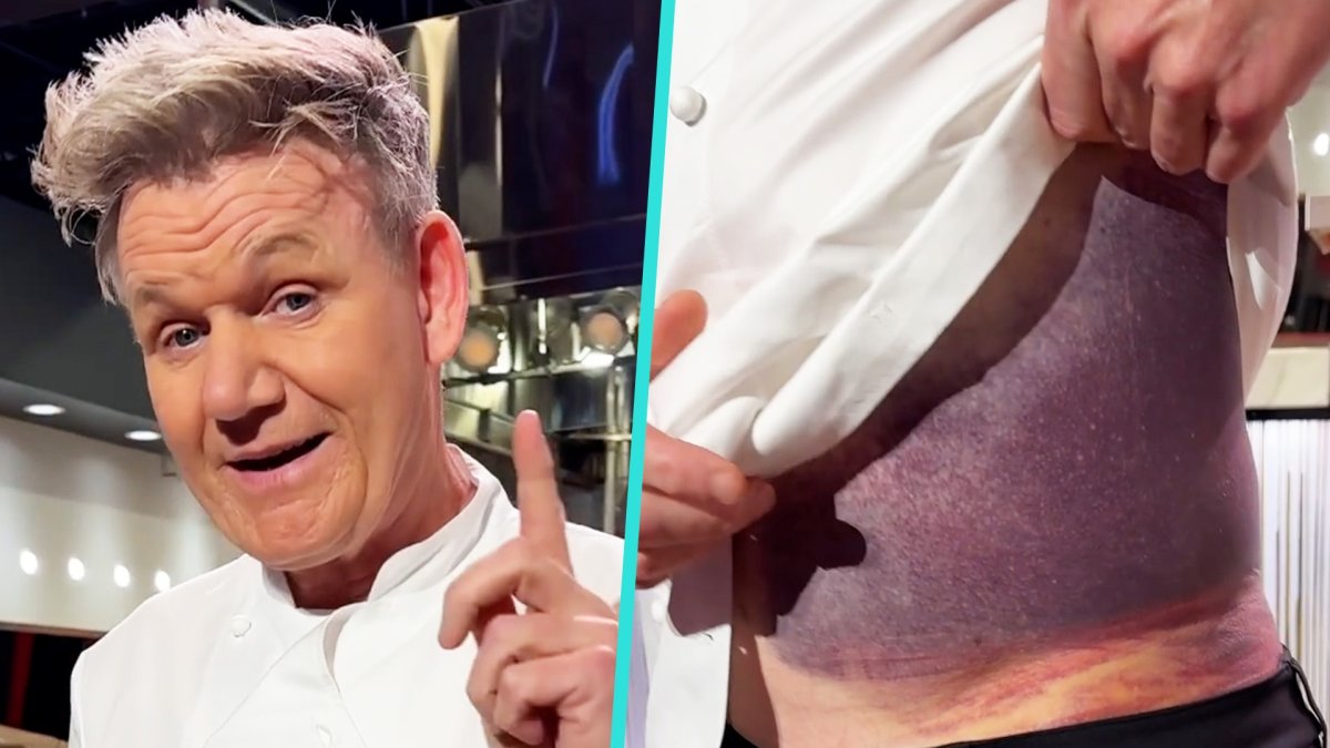 Gordon Ramsay reveals massive bruise after bike accident NBC Los Angeles