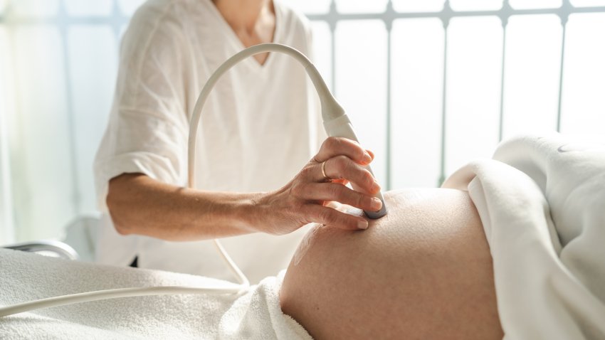 Doctor performing an ultrasound scan to the belly of a pregnant woman