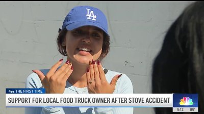 Long Beach food truck owner burns face during work