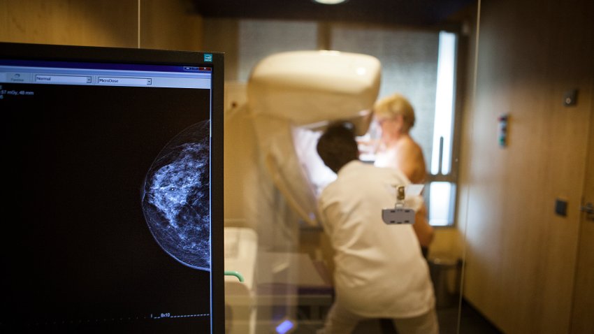 technician carries out a routine mammogram