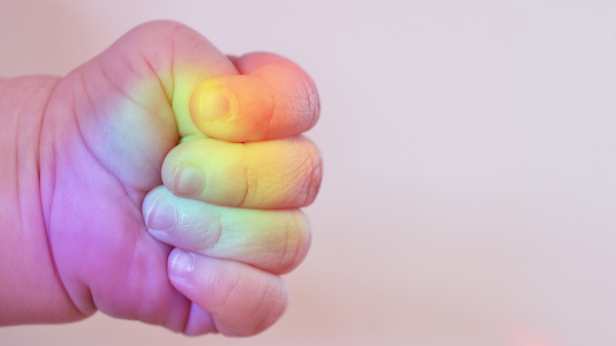 What is a rainbow baby? And why do some parents dislike the term? NBC