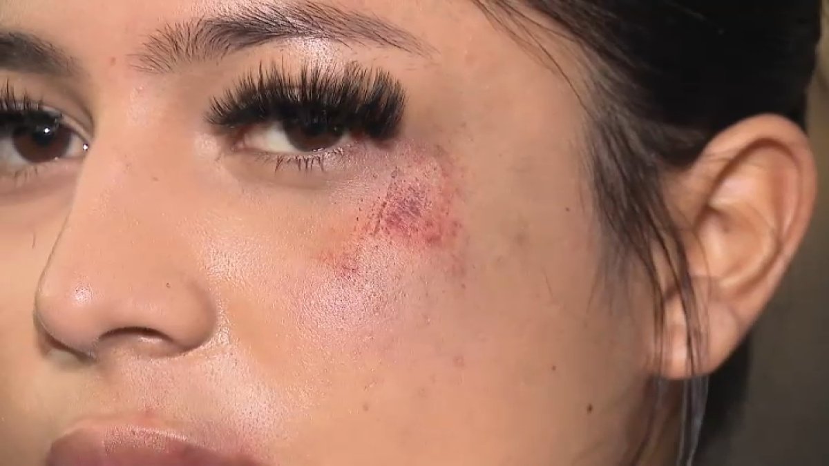 CSUDH student says she was attacked on campus by man – NBC Los Angeles